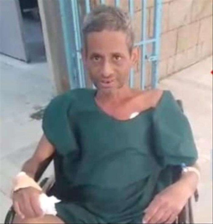 استشهاد الجندي الأسير جمال المحمودي في سجون مليشيات الحوثي الإرهابية