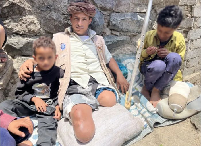  ارتفاع ملحوظ في ضحايا ألغام عصابة الحوثي بالحديدة