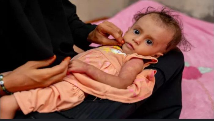  اليونيسف تطلق برنامجًا جديدًا للوقاية من نقص التغذية في اليمن بتمويل ألماني