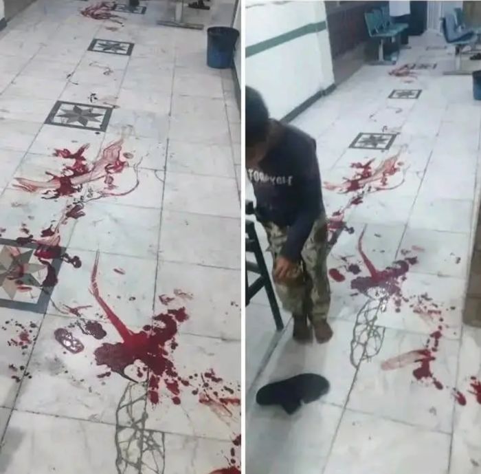  أثاروا الرعب بين المرضى والكادر الطبي .. مقتل مواطن وإصابة آخر جراء اقتحام مسلحين مستشفى الروضة بتعز