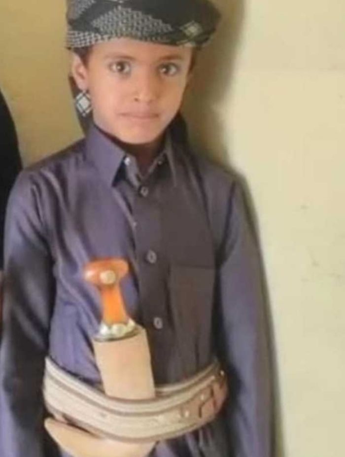  قط يقتل طفلًا في شبوة