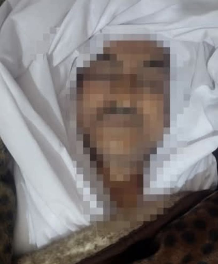  في مدينة يحكمها فاسدون .. مات وهو يبحث عن وايت ماء بتعز