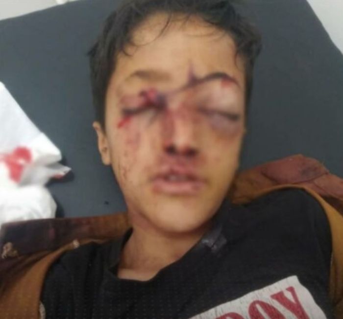  تعز.. قناص حوثي يقتل فرحة طفل بقدوم العيد