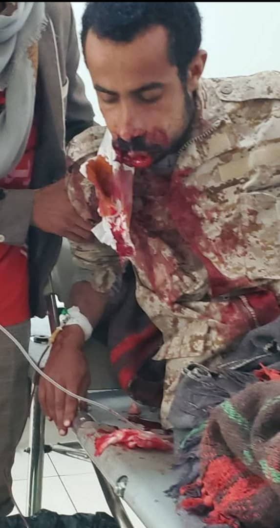 إحتجاز جندي اطلق النار على زميله بنقطة هيجة العبد