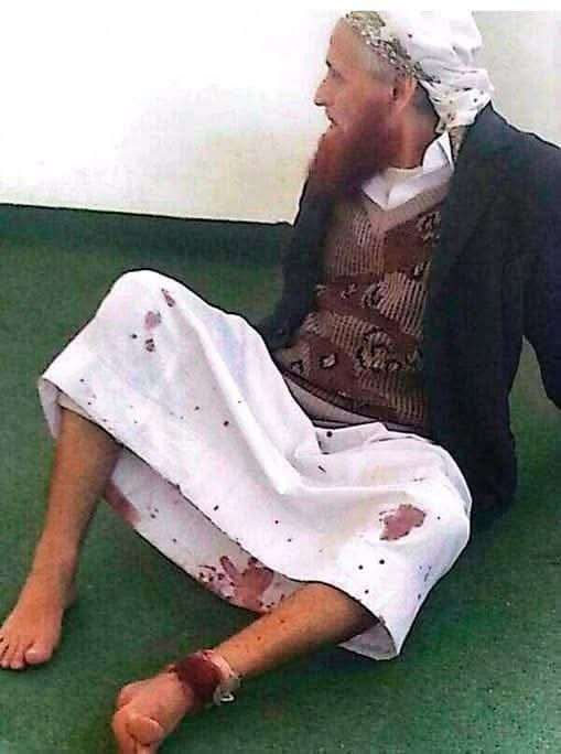 مسلحون حوثيون يطلقون النار على إمام مسجد في ذمار ويطردون آخر في صنعاء