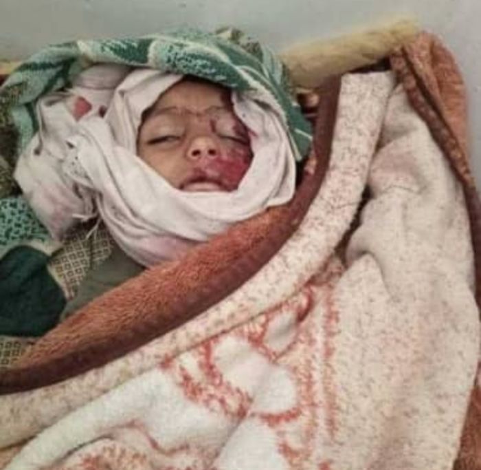  تعز .. طفل يدفع حياته ثمنًا للحصول على شربة ماء