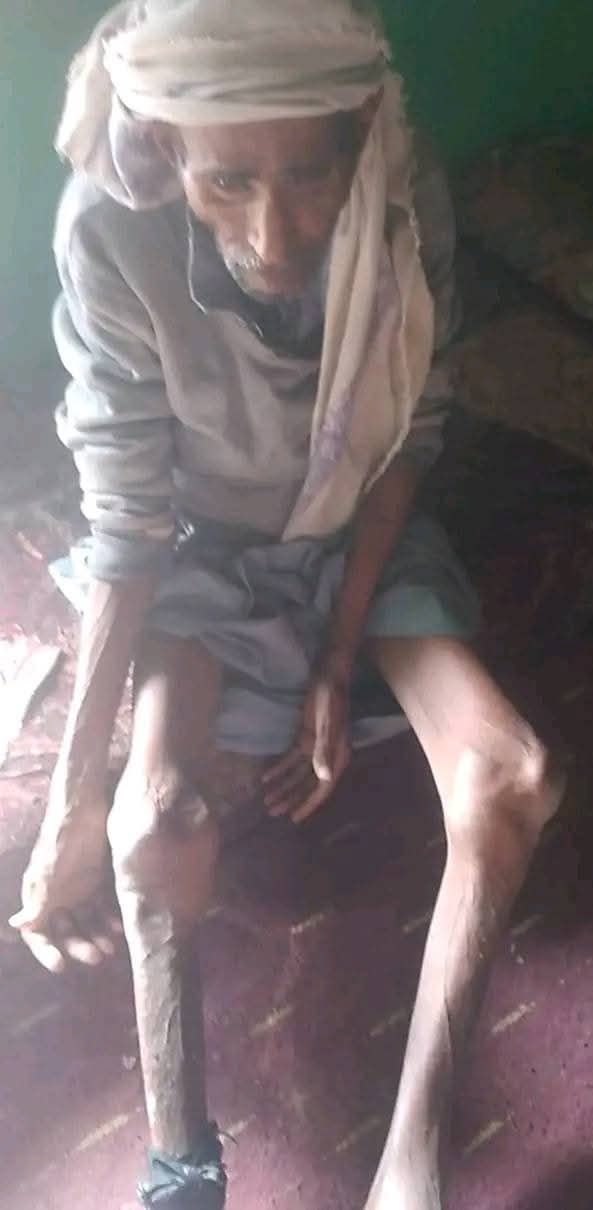 وسط حصار خانق ومجاعة متفاقمة :  عصابة الحوثي تفرض عقابًا جماعيًا بحق سكان حجور منذ 2019