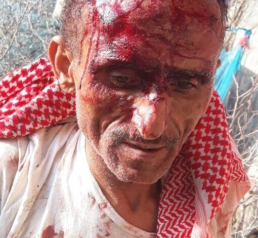 الشبكة اليمنية للحقوق والحريات تدين اعتداء حوثي وحشي على طبيب مساعد في إب
