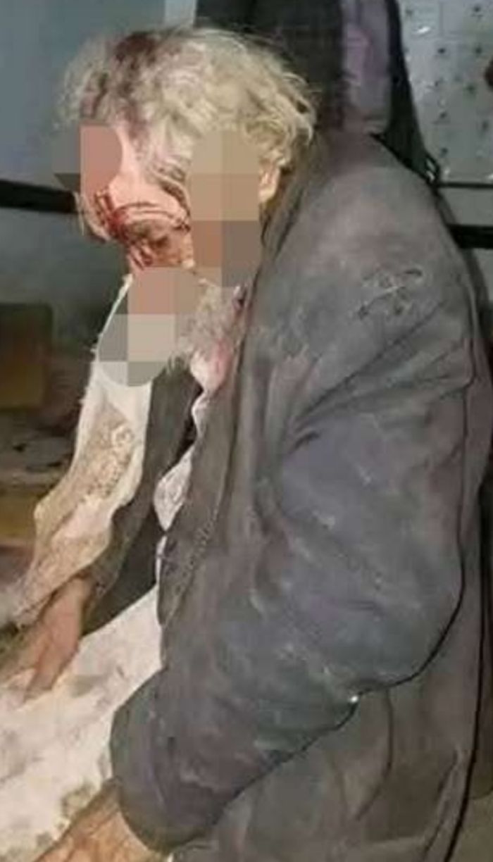  رموه بالحجارة حتى شُجَّ رأسه .. شبان في إب يعتدون على مسن بغرض التسلية