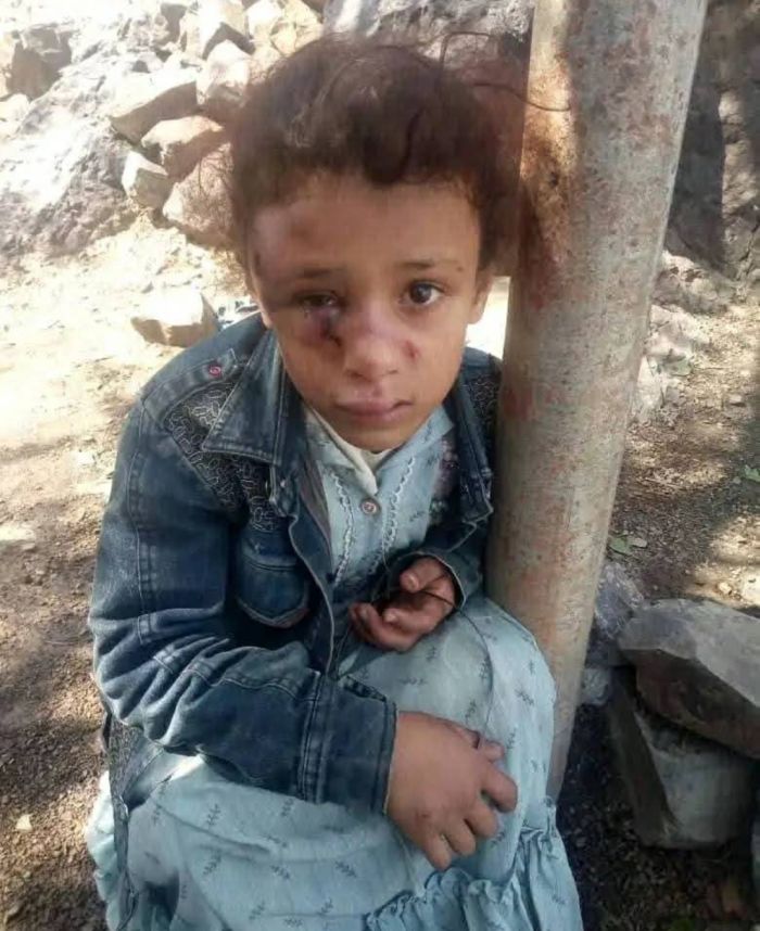  جريمة اجتماعية بشعة .. عم يعتدي على ابنة أخيه وأمها في تعز