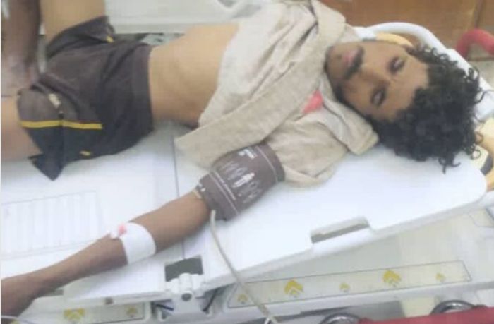  إصابة مواطن بانفجار لغم حوثي في الجوف