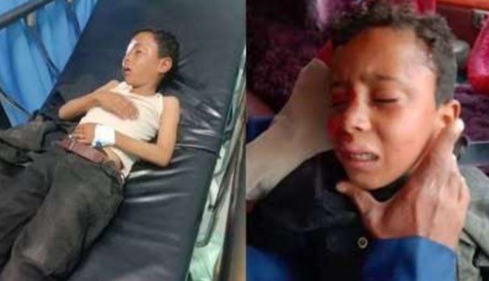  الضالع.. سائق يدهس طفلًا ويتركه ينزف في الطريق العام