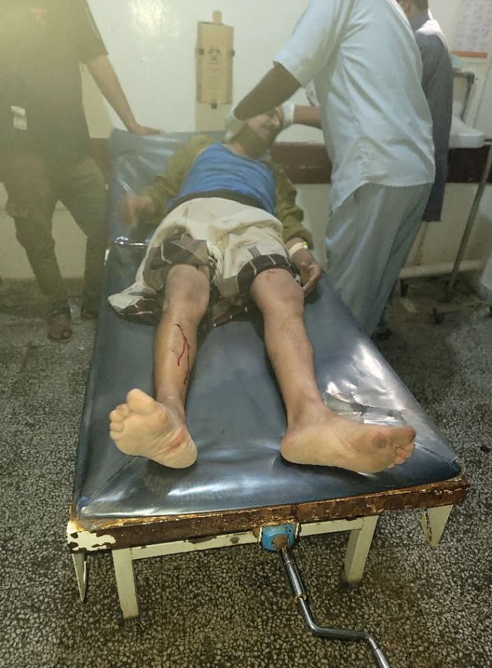 مسلحون يعتدون بالضرب على الدكتور نظير العامري في الضالع