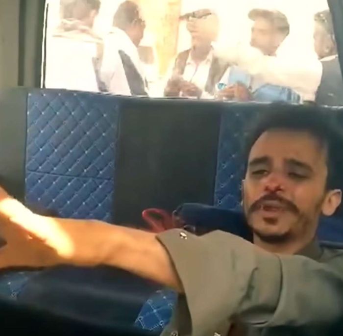 اعتداء حوثة الحصبة على سائق باص يثير موجة استياء في صنعاء