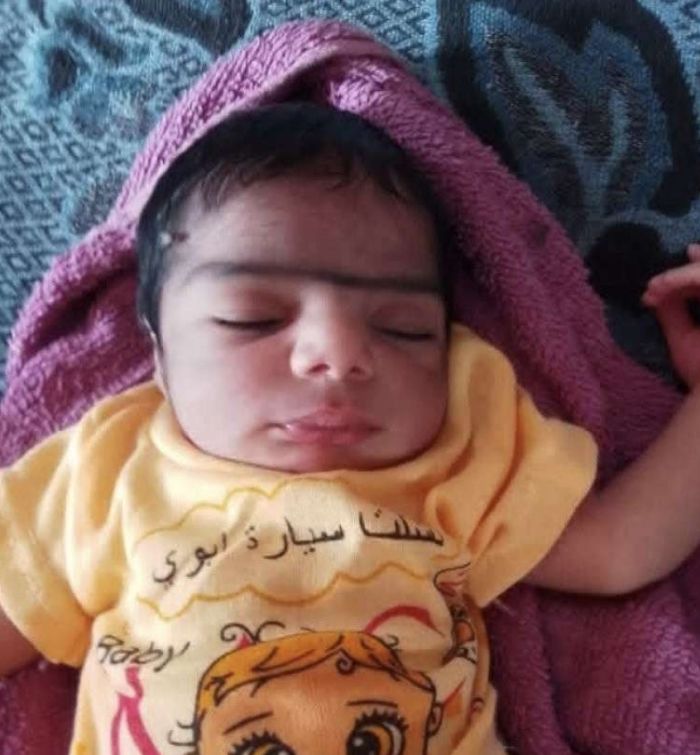 العثور على طفل رضيع مرمي بين أشجار كيلوا 16 في الحديدة