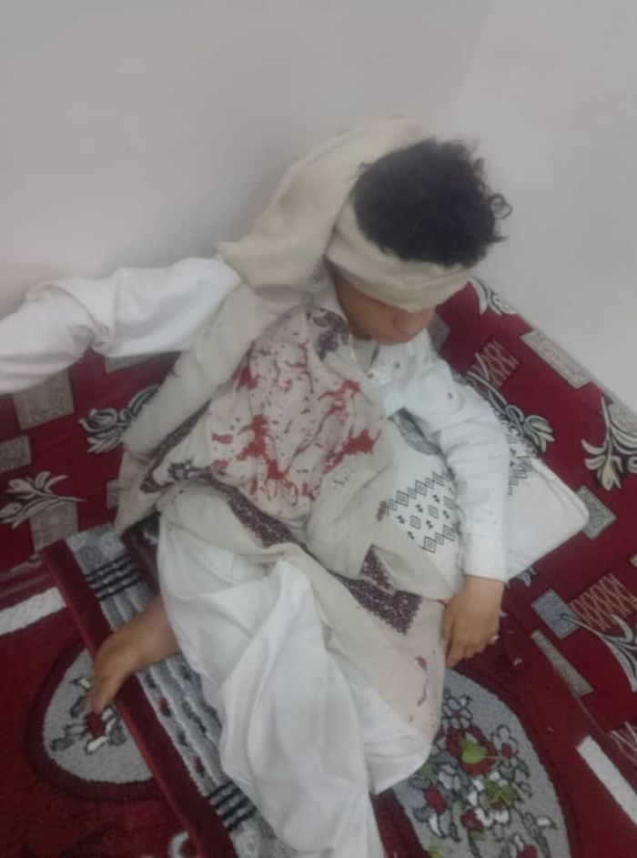 جرائم عنف مروّعة ضد أطفال تكشف انفلات أمني خطير في مناطق الحوثيين