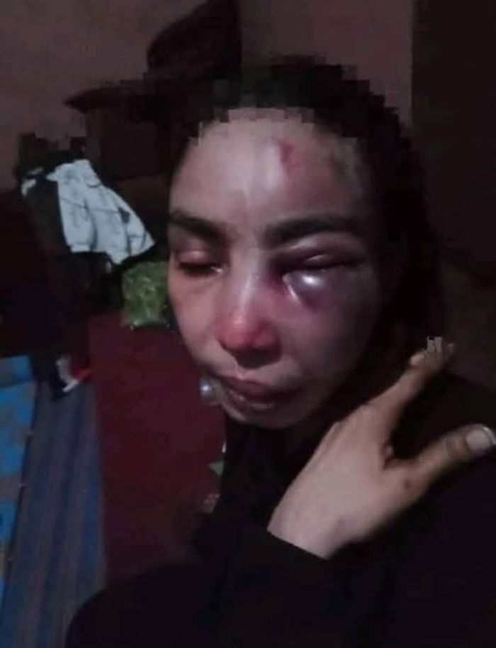  تعرض امرأة للضرب المبرح على يد جندي في اللواء 170 بتعز