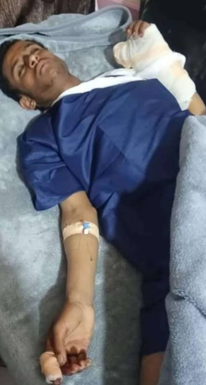  إب.. سائق (متر)  يتعرض للطعن وأصابع الاتهام تشير إلى عصابات حوثية