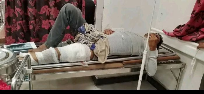  ضمن جرائم الانفلات الأمني .. مسلح يعتدي على بائع آيسكريم في مدينة تعز