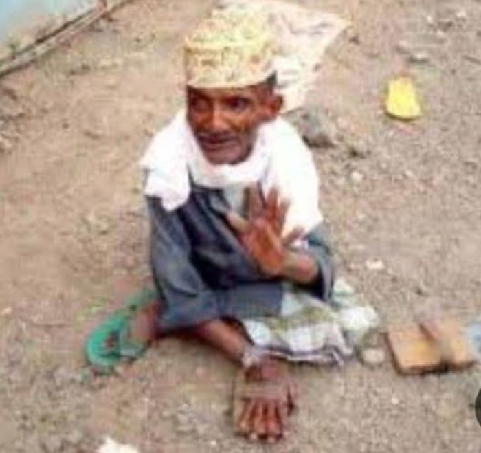  القدسي.. معاق حركيًا يلقى مصرعه بدهس أطقم أمن الشمايتين