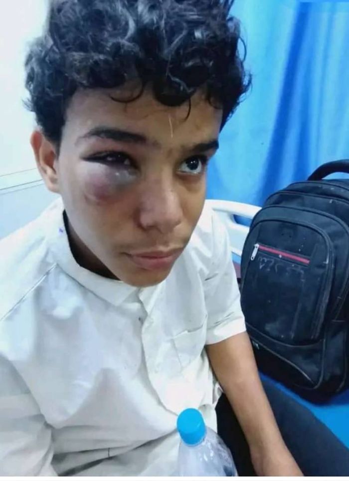 لاجئون أفارقة يعتدون على طفل أمام إدارة أمن المكلا