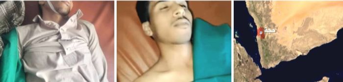  مليشيا الحوثي تقتل مواطنًا تحت التعذيب بعد استدعائه إلى مقر أمني في حجة