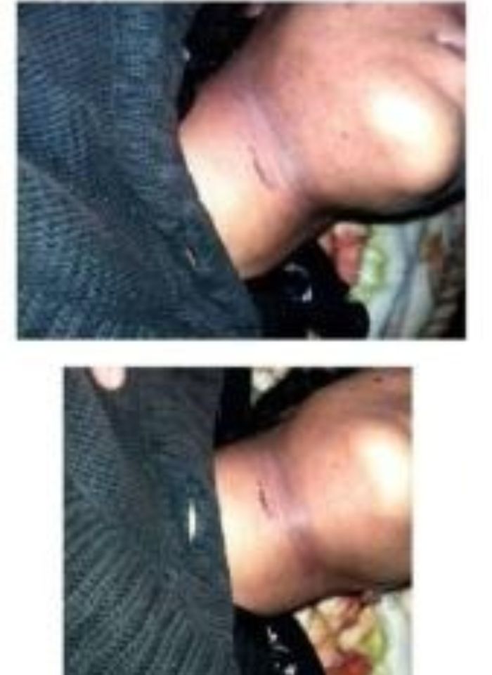  العدالة المدفونة .. كيف نجح زوج "أمل العصار" بقتلها وحرقها ودفنها سراً ثم حصل على "براءة" من القضاء؟  مأرب تهتز .. تحليل دقيق لوثائق النيابة التي طالبت بالإعدام، والأدلة الطبية التي أثبتت الخنق، وحكم المحكمة الصادم الذي برأ المتهمين العسكريين