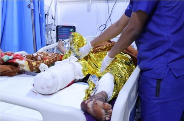  إصابة 4 مدنيين بانفجار لغمين من مخلفات عصابة الحوثي غرب تعز