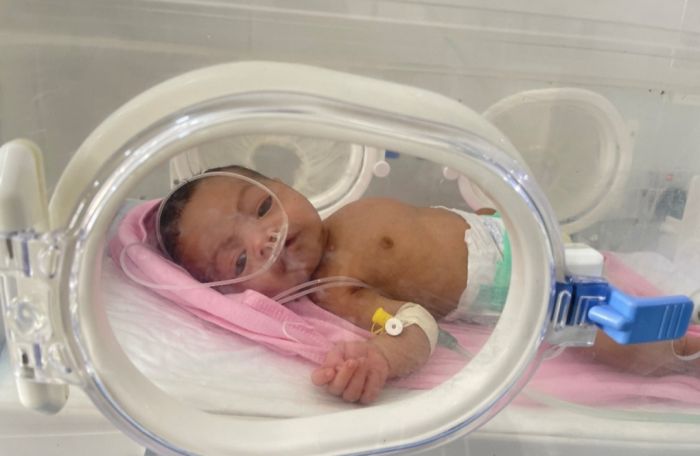  الصحة العالمية: اليمن يسجل ارتفاعًا خطيرًا في وفيات الولادة المبكرة