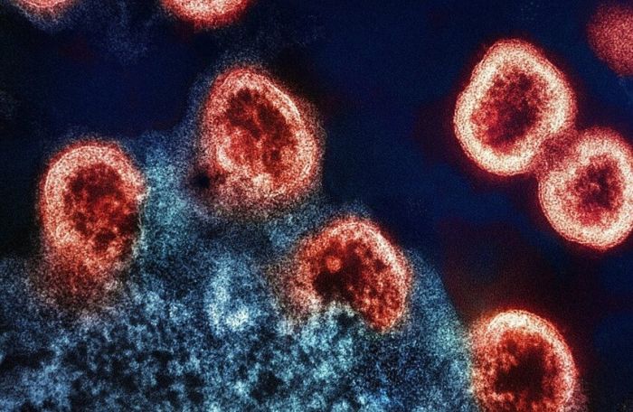 العلماء يكتشفون سبب صعوبة القضاء على الإيدز!