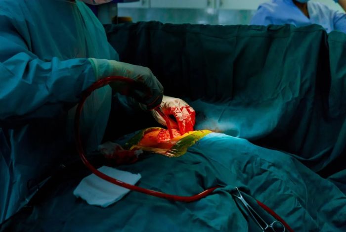 علاج واعد لمرض الكلى في مرحلته النهائية