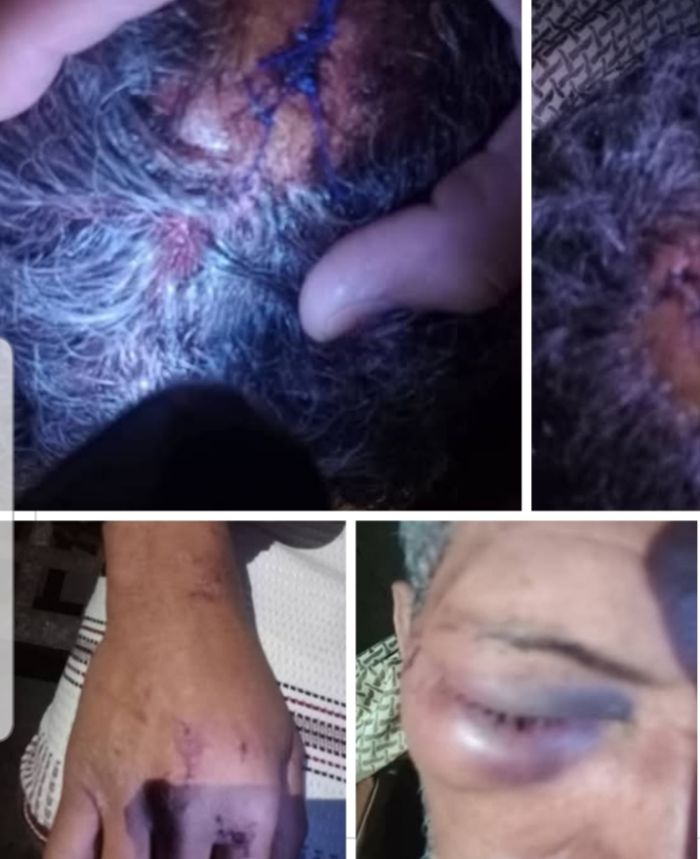 استياء واسع بعد اعتداء حارس مدير الشمايتين وشقيقه على مواطن ستيني في سوق المديرية