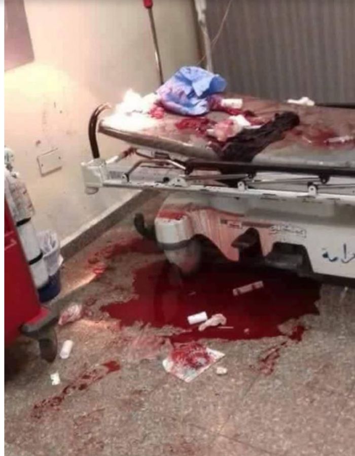 تصاعد التوتر في حضرموت.. اشتباكات مسلحة بين قوات المجلس الانتقالي ومسلحي حلف القبائل وإصابة مدنيين