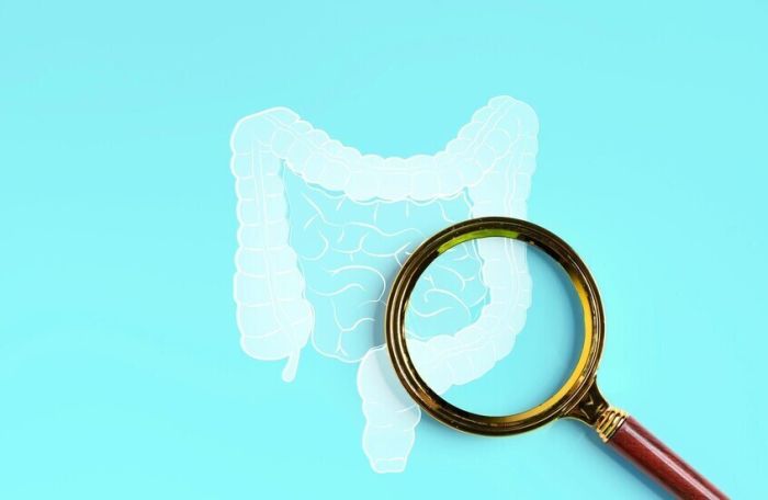 اكتشاف علاقة بين أدوية الكوليسترول وسرطان القولون