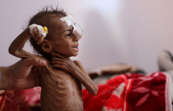  فيما تؤكد الأمم المتحدة أن اليمن يواجه أسوأ أزمة إنسانية منذ 10 أعوام.. زعيم الحوثيين ينقذ نظام إيران بمليار دولار