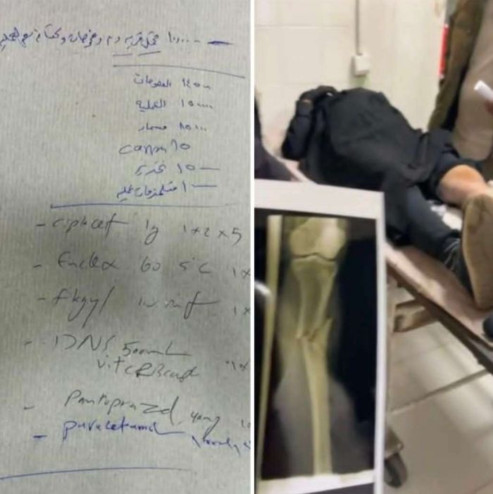  باص يدهس امرأة فقيرة ويفر، ومستشفى الثورة يطالبها بسداد مبلغ مالي لإجراء العملية