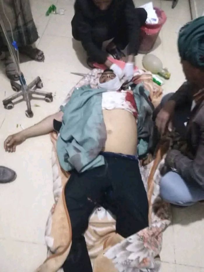 قتيل وجريحان في حوادث عنف متفرقة بإب وذمار وسط انفلات أمني متواصل