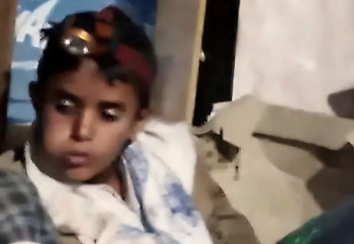 وفاة طفل في ظروف غامضة داخل مزرعة قات بمحافظة عمران