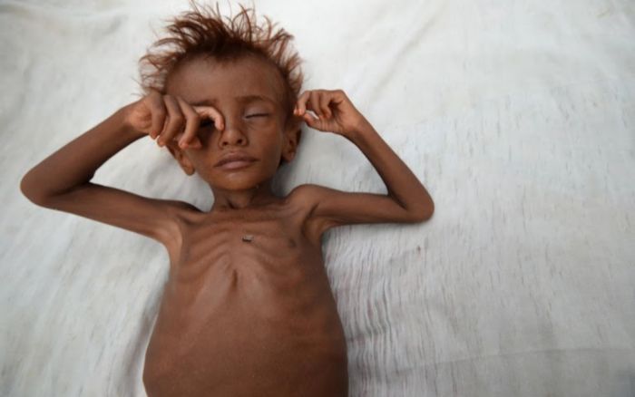  اليمن تتصدر قائمة الدول الأكثر معاناة من انعدام الأمن الغذائي