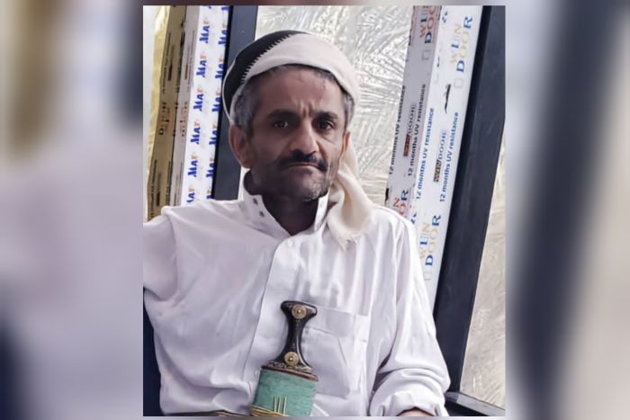 لدغة ثعبان تفضح إهمال الحوثيين: وفاة مواطن بريمة بسبب انهيار القطاع الصحي وغياب أبسط مقومات الإسعاف