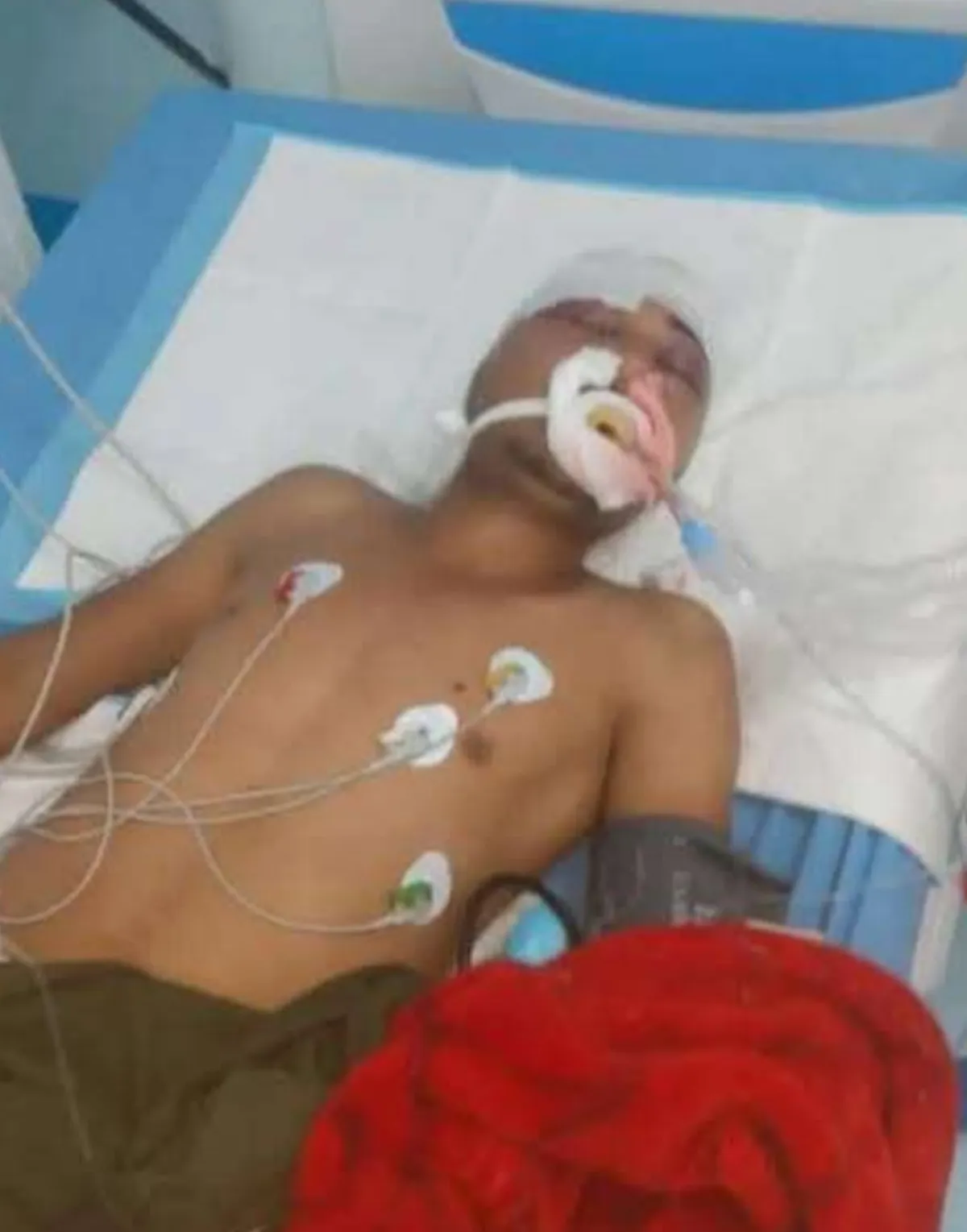 سقوط شاب من الدور الرابع في مقبنة نتيجة اختلال توازنه