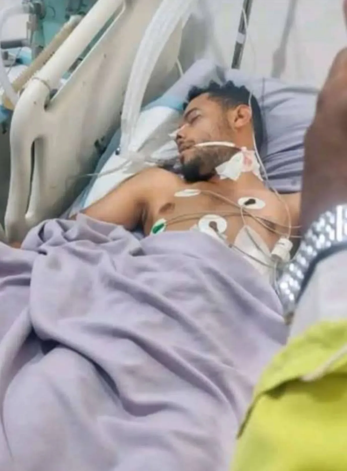 تعز.. إصابة بائع قات أثناء تعرض محله للسطو المسلح في المسراخ