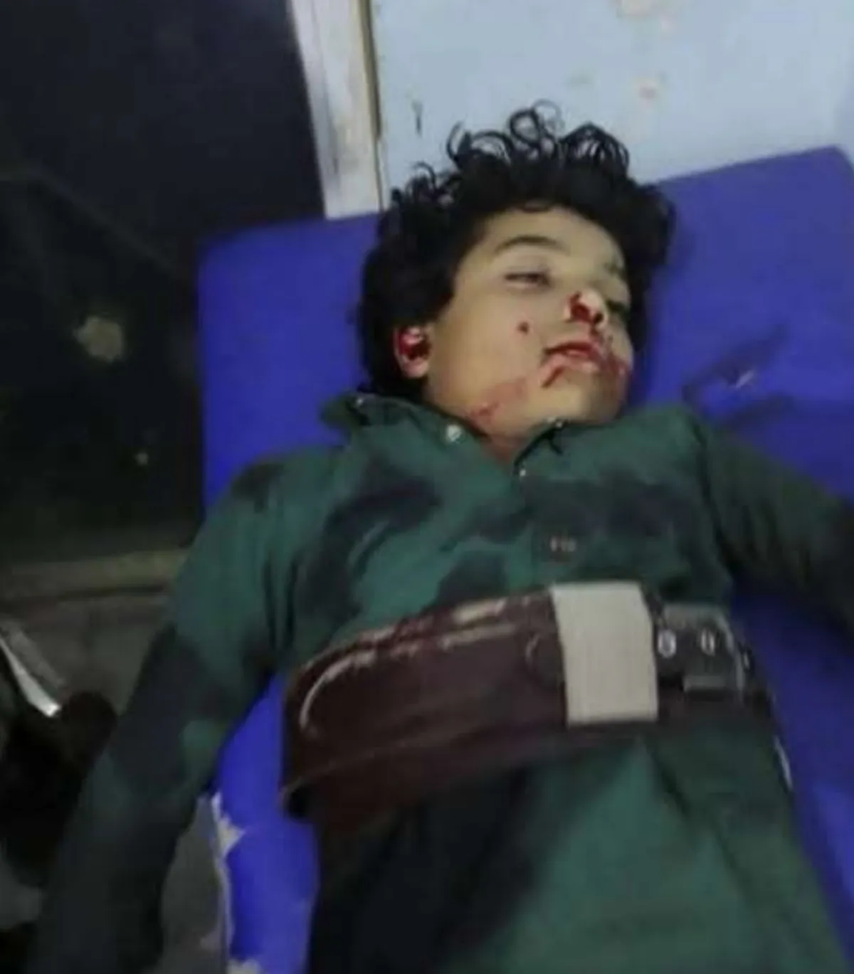 مصرع طفل برصاص مسلح حوثي في سوق بإب