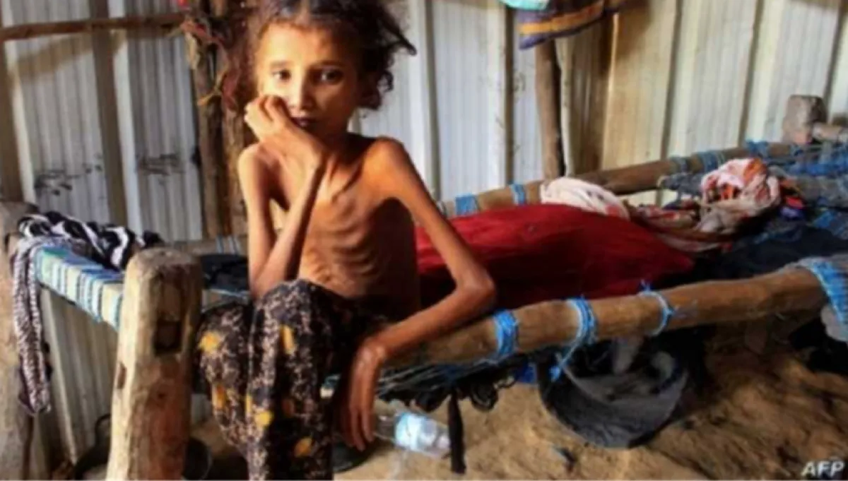 الصليب الأحمر: اليمن من أكثر دول النزاع احتياجاً للمساعدات الإنسانية