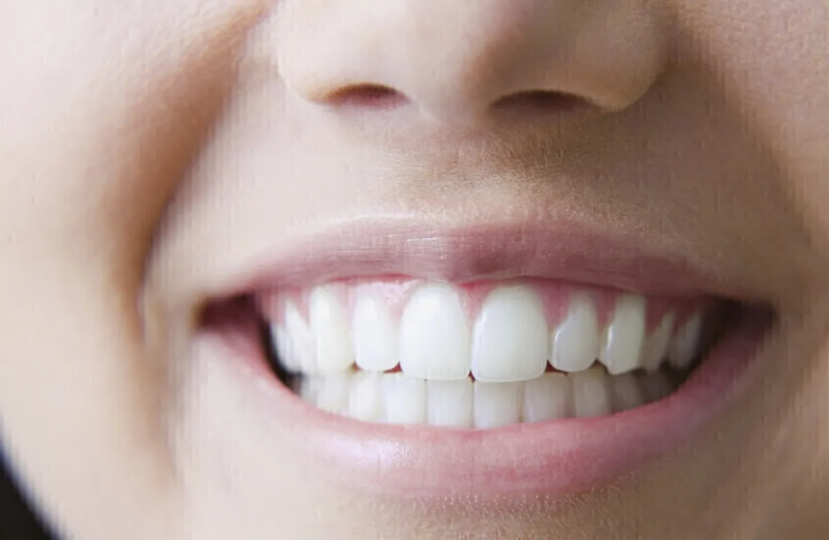 اكتشاف روسي بطريقة الليزر لتجديد أنسجة الفم واللثة