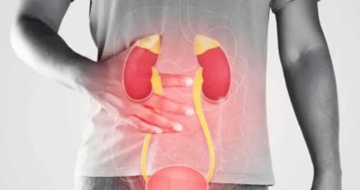 مرض الكلى المزمن: دليلك للمراحل الخمس وتدابير الوقاية الفعالة