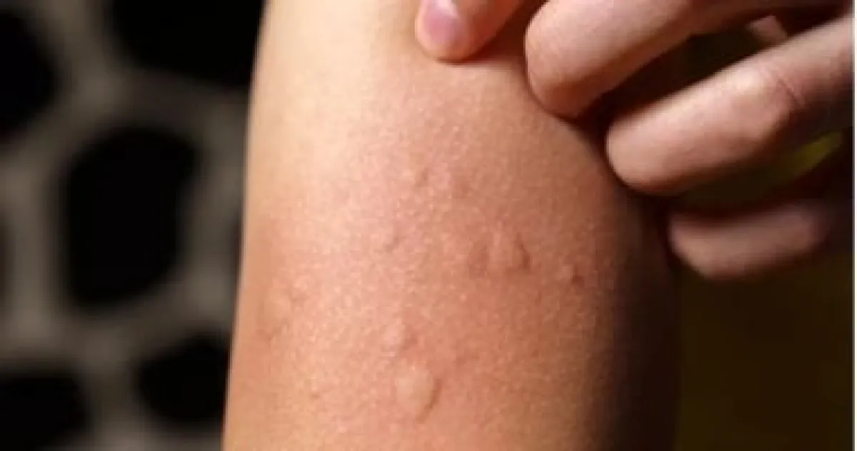 وداعاً لحكة الجلد: 4 نصائح فعالة للتعامل مع المشاكل الجلدية الشائعة