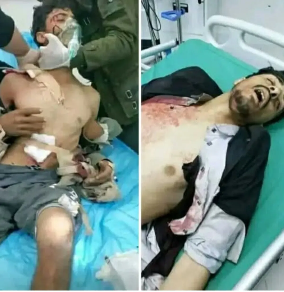 خلاف على درج منزل في المحويت ينتهي بمجزرة عائلية وإصابات خطيرة