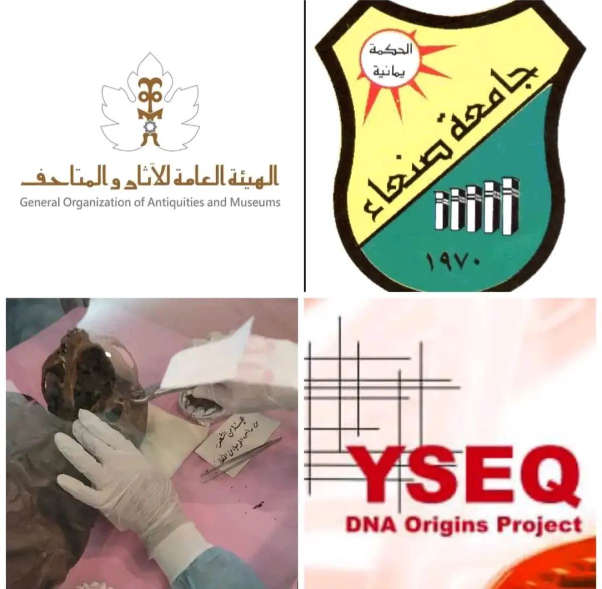 لأول مرة.. إخضاع مومياوات يمنية لتحليل الحمض النووي القديم