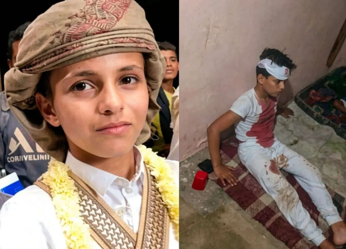 تعرض أصغر عريس في اليمن للاعتداء بالرمي بالحجارة
